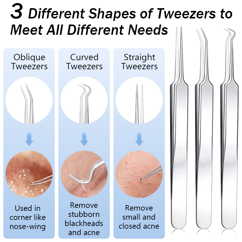 Stainless Steel Acne Blackhead - Luxury Skincare Acne review and price