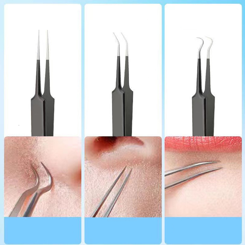 4/6PCS Face Cleaning Kit Pimpl - Luxury Skincare Acne review and price