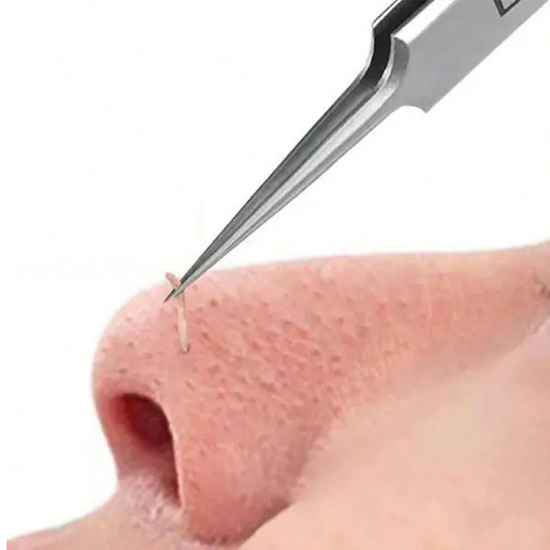 4/6PCS Face Cleaning Kit Pimpl - Luxury Skincare Acne review and price