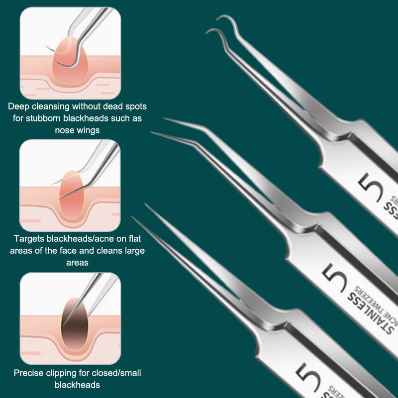 7/8Pcs Blackhead Remover Kit P - Luxury Skincare Acne review and price