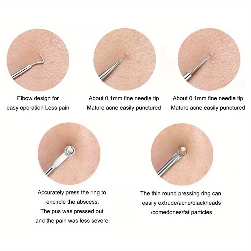 Pimple Popper Tool Kit Blackhe - Luxury Skincare Acne review and price