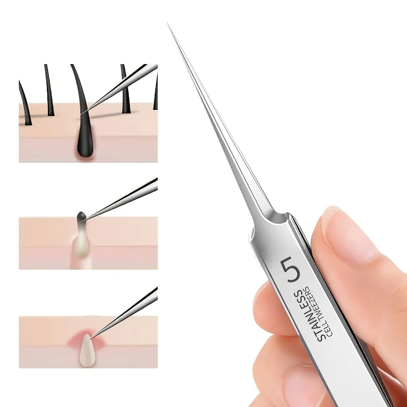 Higt Quality Acne Blackhead Re - Luxury Skincare Acne review and price