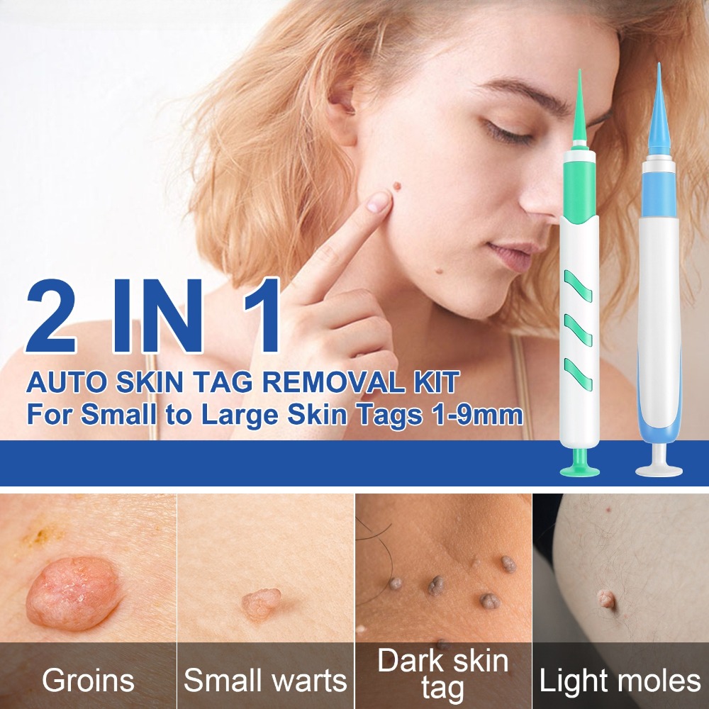 2-IN-1 Auto Skin Tag Removal T - Luxury Skincare Acne review and price