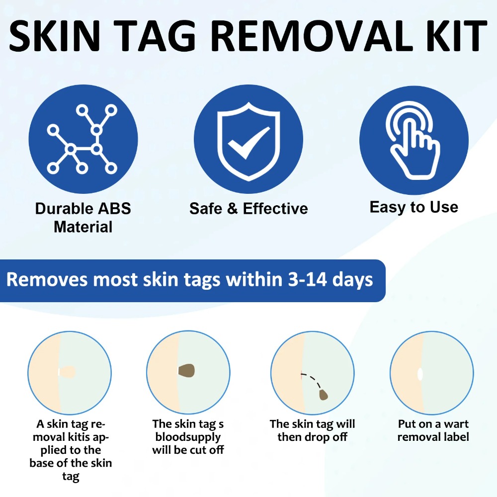 2-IN-1 Auto Skin Tag Removal T - Luxury Skincare Acne review and price