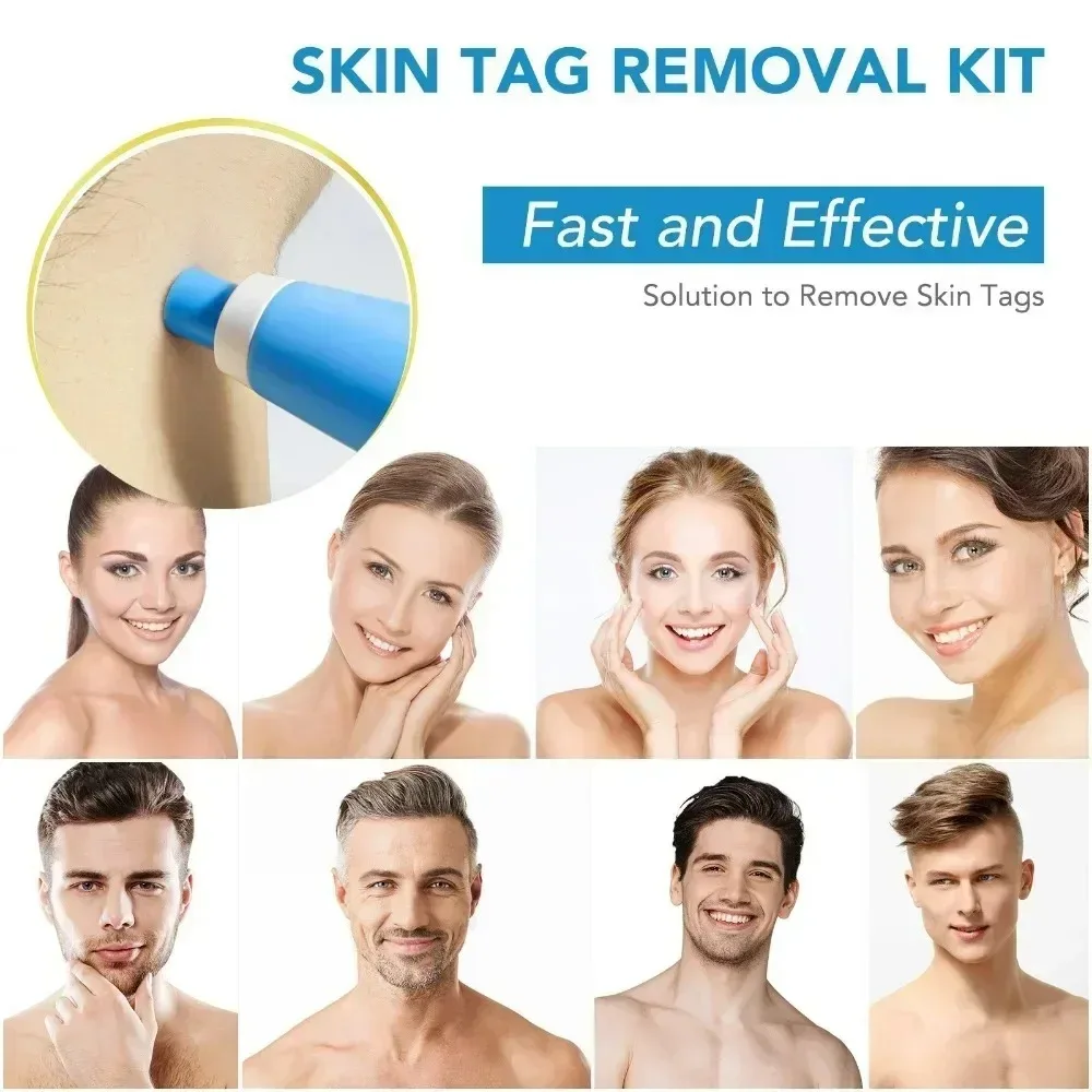 Acne Remover 2 IN 1 Auto Micro - Luxury Skincare Acne review and price