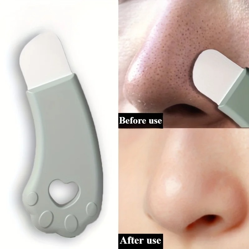 Cat Paw Blackhead Remover Tool - Luxury Skincare Acne review and price