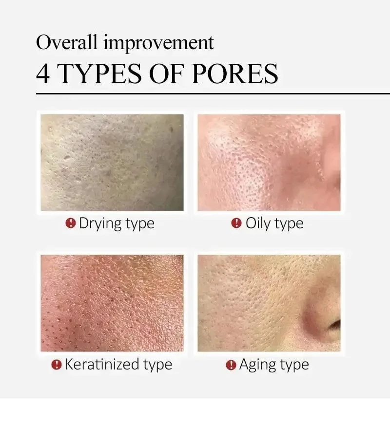 Centella Asiatica Shrink Pores - Luxury Skincare Korea review and price
